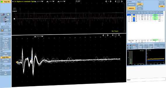TrueTrace SFEMG / Macro EMG